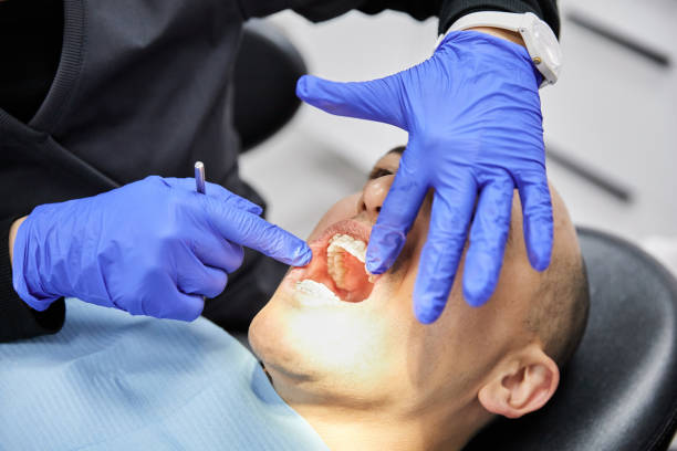 Best Affordable Emergency Dental Care  in Calverton Park, MO